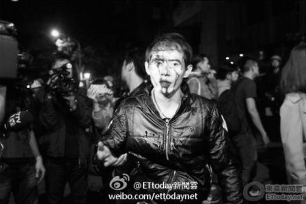 En demonstrant med blodigt ansikte efter sammandrabbningarna mellan polis och studenter framför Taiwans regeringsbyggnad i Taipei, 24 mars 2014. (Weibo.com)