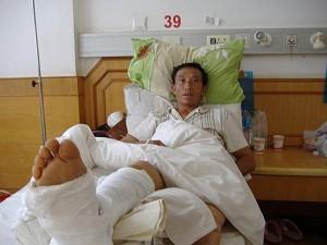 En av de skadade byborna efter myndigheternas tillslag mot en by i Wenshan. (Foto från en boende i byn)
