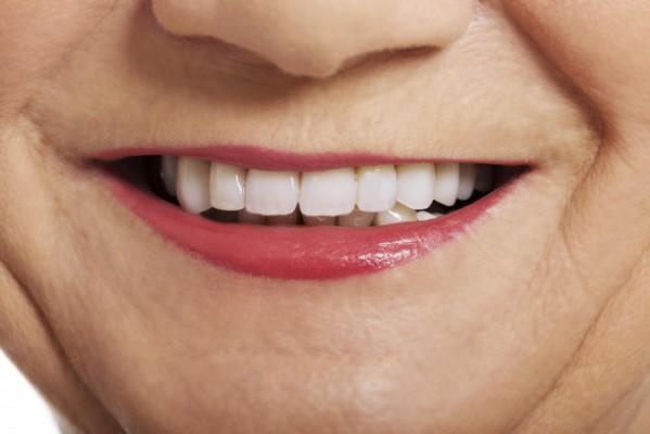 Raka, rena tänder hjälper din allmänna hälsa. (Foto: b-d-s/iStock/Thinkstock)