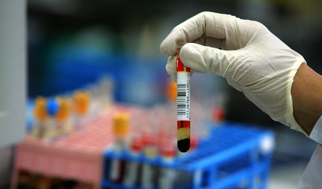 Blodgruppen påverkar risken att drabbas av hjärtinfarkt och stroke, visar forskning. Foto: David Silverman/Getty Images