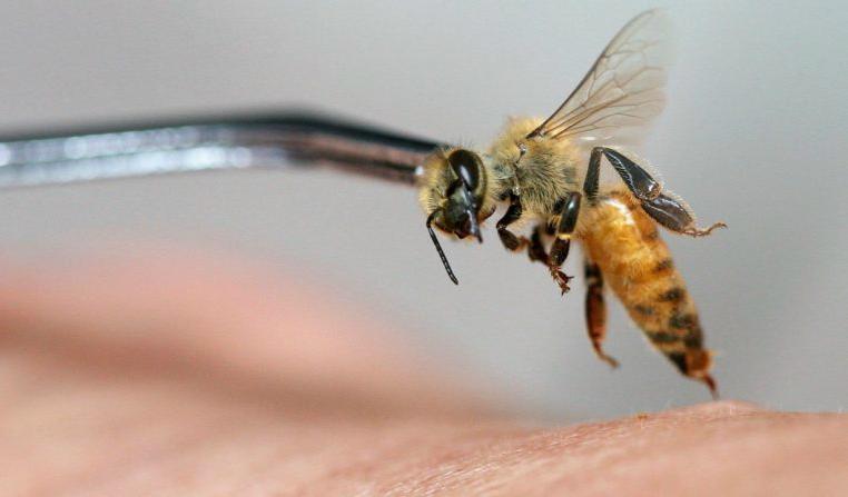 En apiterapeut practitioner framkallar ett bistick på patientens hand på Cibubur Bee Center den 5 april 2007, på Jakarta, Indonesien. Foto: Dimas Ardian/Getty Images