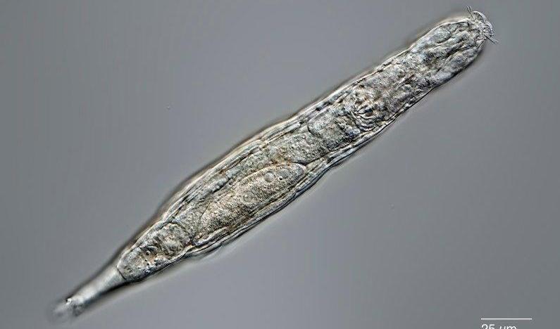 Hjuldjur är extremt tåliga flercelliga organismer som klarar av både köld och torka. Nu har forskare återupplivat ett hjuldjur som legat infryst i den sibiriska permafrosten i 24|000 år. Det finns många olika arter, varav många inte ens syns med blotta ögat. Foto: Michael Plewka/TT