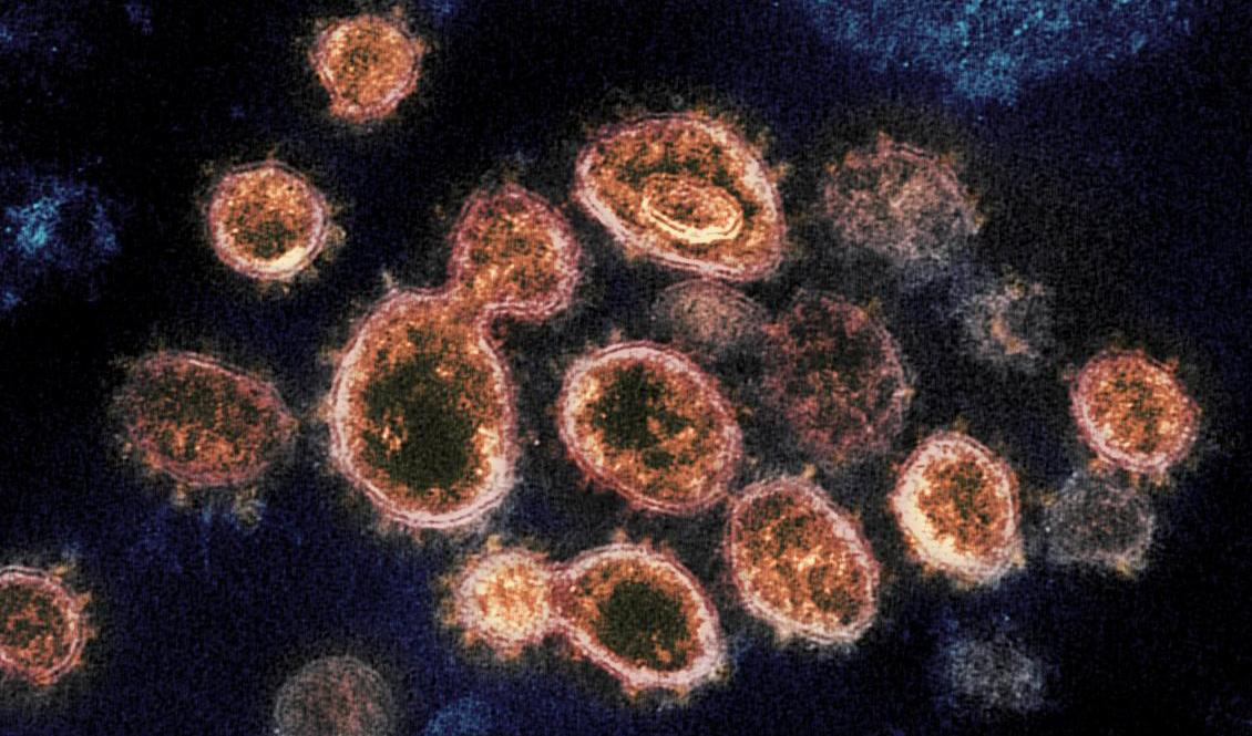Mängden viruspartiklar i lungorna avgör risken att dö vid svår sjukdom. Foto: National Institute of Allergy and Infectious Diseases/TT