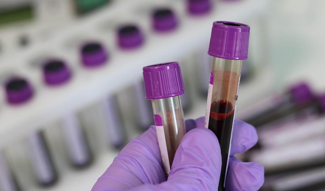 Främmande ämnen har hittats i blodet hos patienter som vaccinerat sig mot covid-19, enligt en italiensk studie. Foto: Pixabay