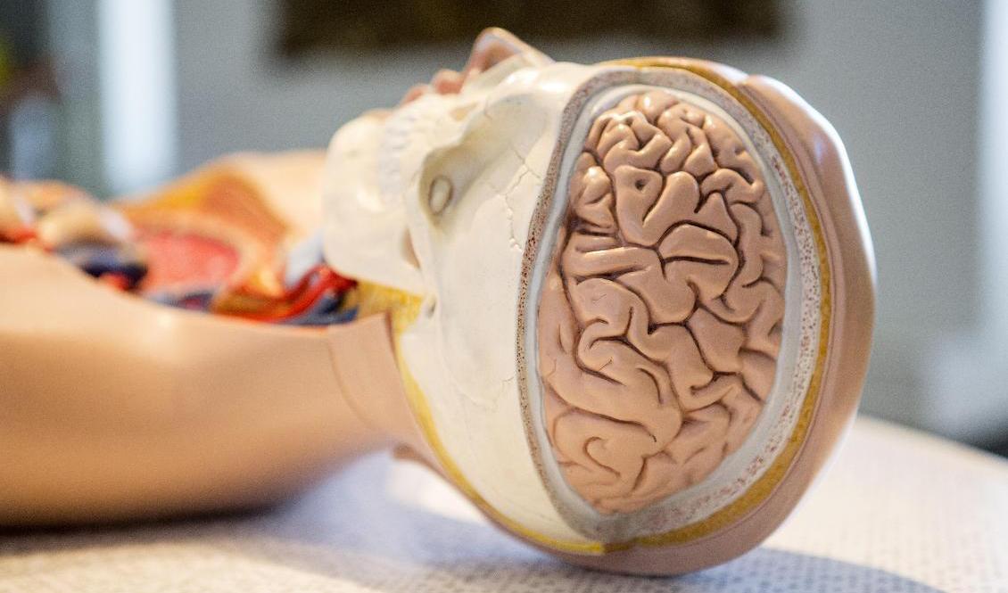 Var fjärde person som drabbas av stroke dör inom 28 dagar, visar statistik från Socialstyrelsen. Arkivbild. Foto: Christine Olsson/TT