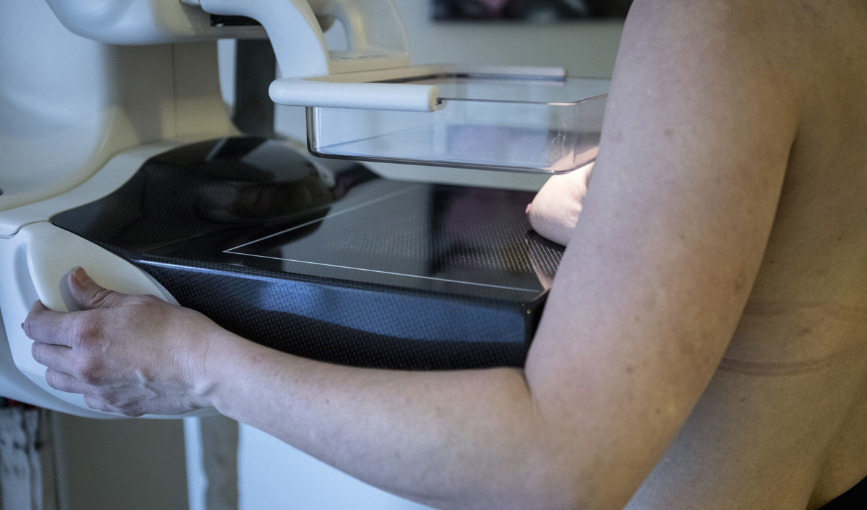 Mammografi är en viktig del för att upptäcka bröstcancer. Arkivbild. Foto: Christine Olsson/TT