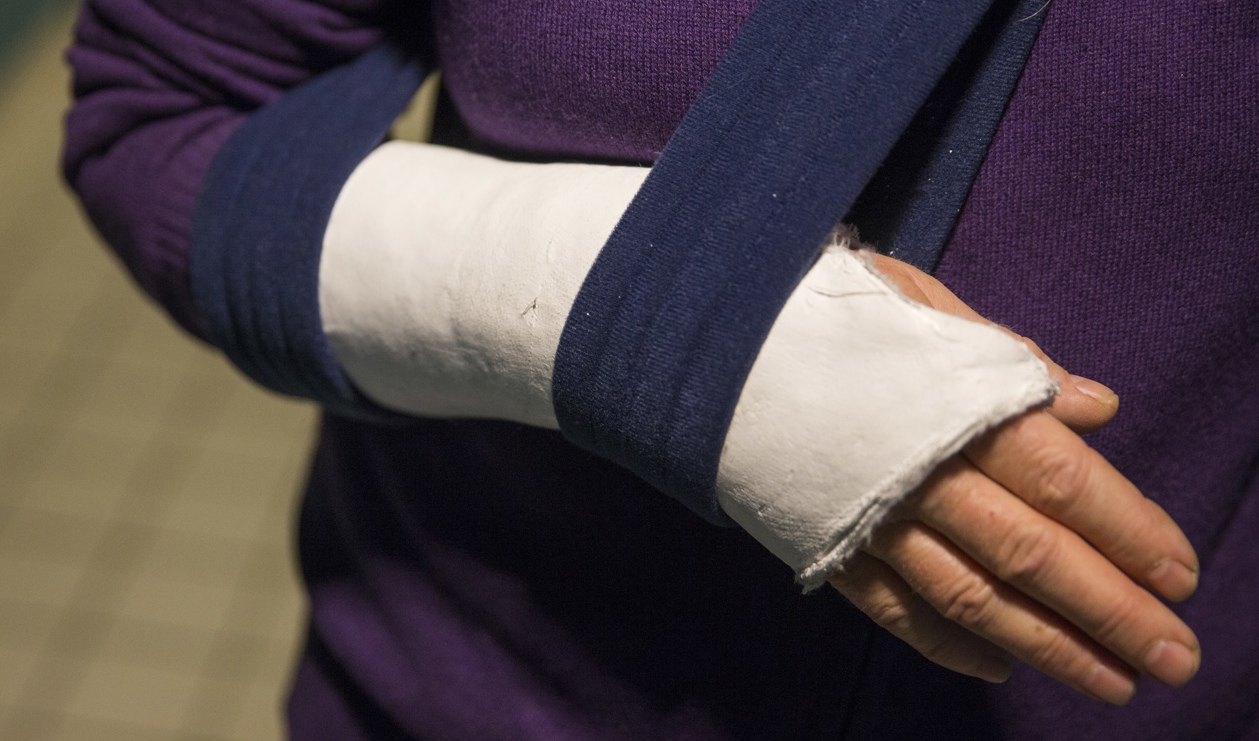 Armslingor, som bland annat används som stöd efter ett benbrott, är ett exempel på en produkt som inte klassificeras om ortopedisk. Arkivbild. Foto: Håkon Mosvold Larsen/NTB/TT