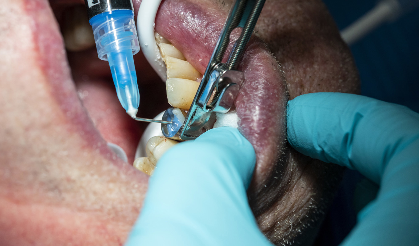 En tandläkare blir av med legitimationen sedan han begått en rad grova fel. Arkivbild. Foto: Tore Meek/NTB/TT