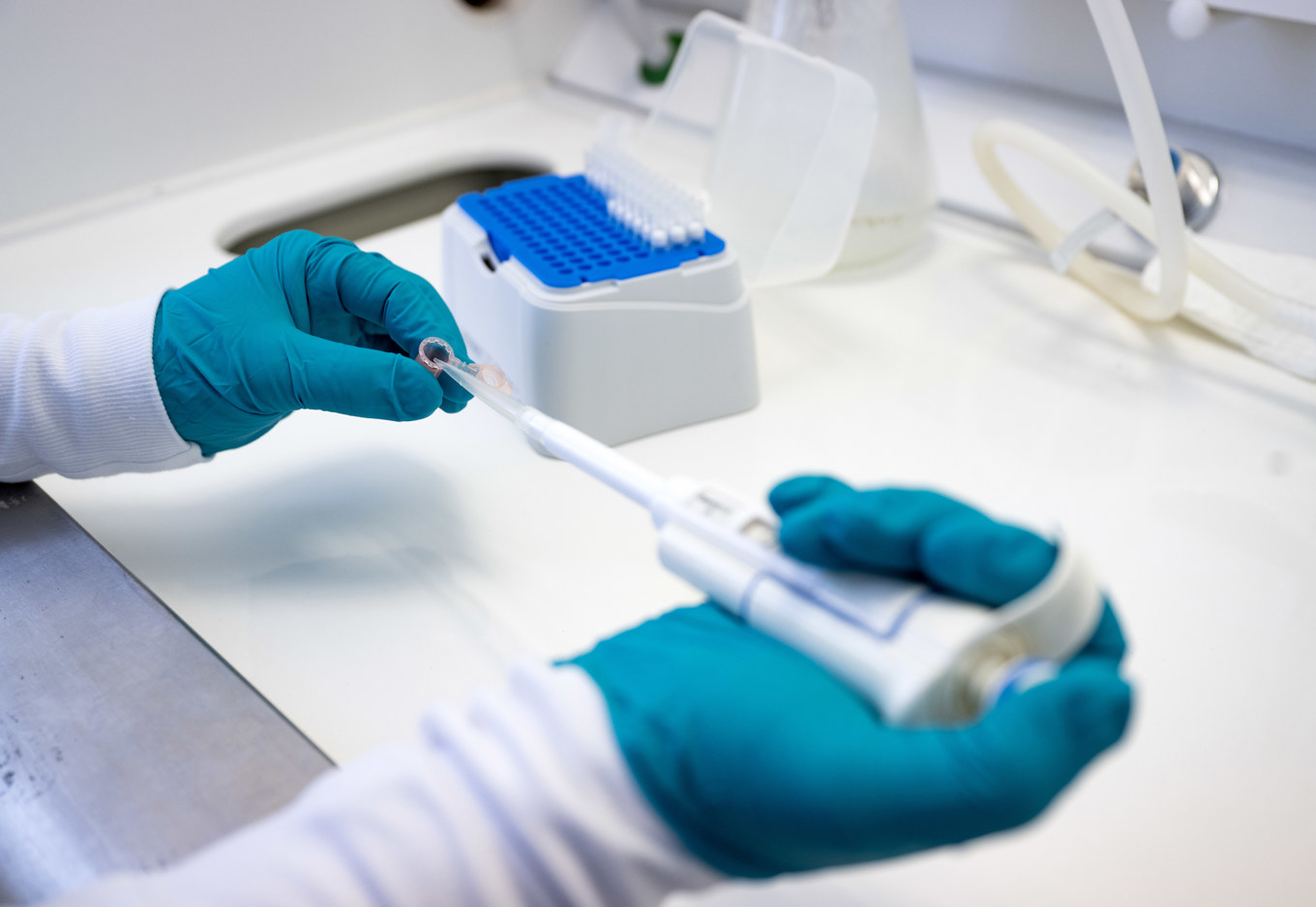 Nya metoden kan ge mer information jämfört med tidigare metoder. Arkivbild. Foto: Pontus Lundahl / TT