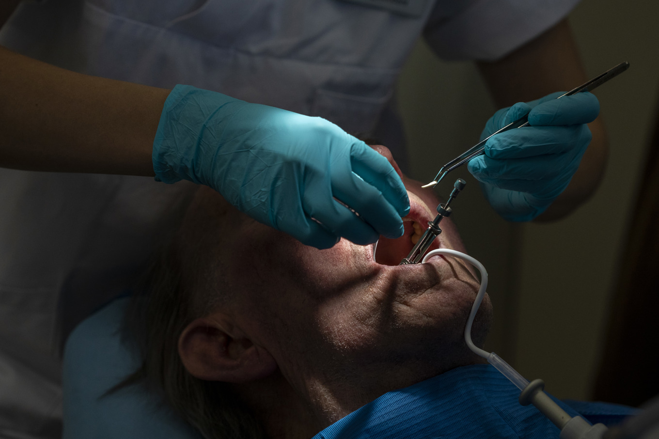 En patient fick 20 av sina tänder utdragna på en och samma gång. Arkivbild. Foto: Tore Meek/NTB
