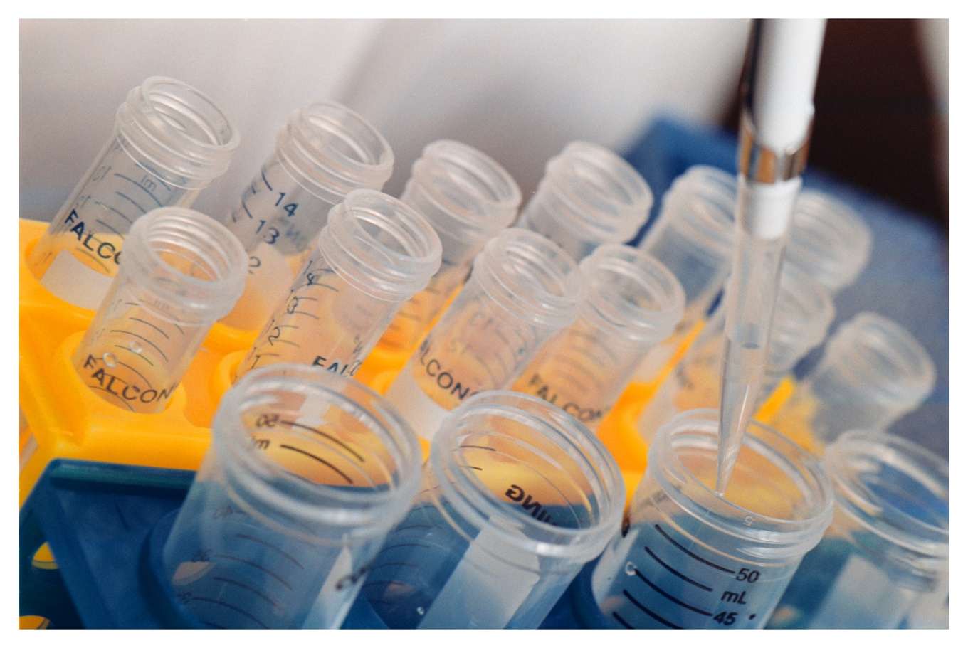 Andelen positiva drogtester har ökat. Värst är det inom byggsektorn. Arkivbild. Foto: Fredrik Persson/TT