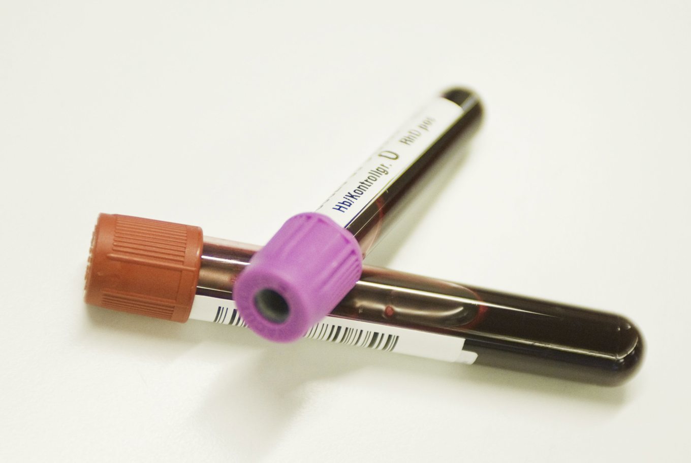 En ny blodgrupp har upptäckts hos en kvinna från den karibiska ön Guadeloupe. Arkivbild. Foto: Markus Dahlberg / TT