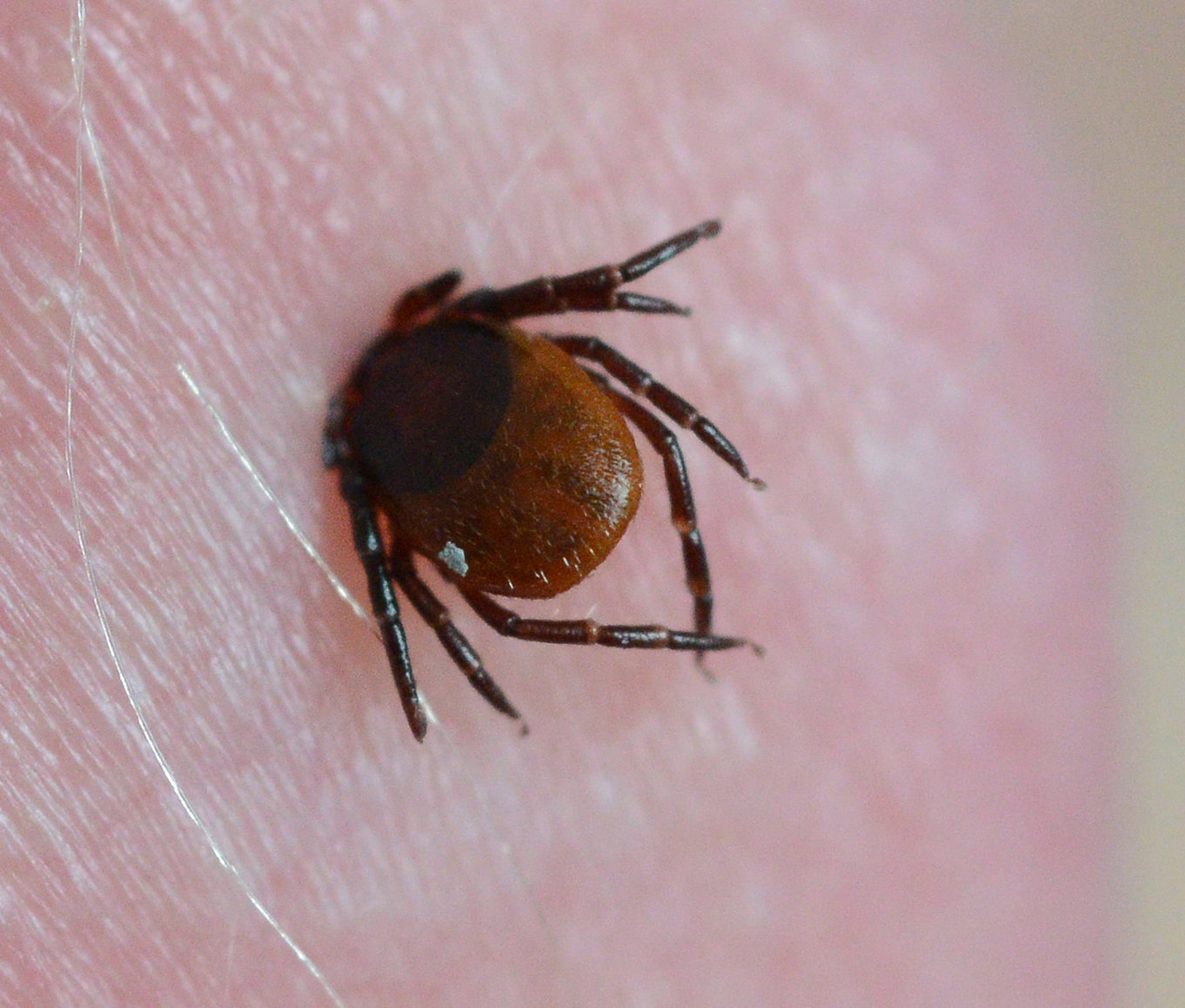 En fästing som satt sig fast på ett öra. Varje år dör ett tiotal personer i Sverige av TBE. Arkivbild. Foto: Johan Nilsson/TT