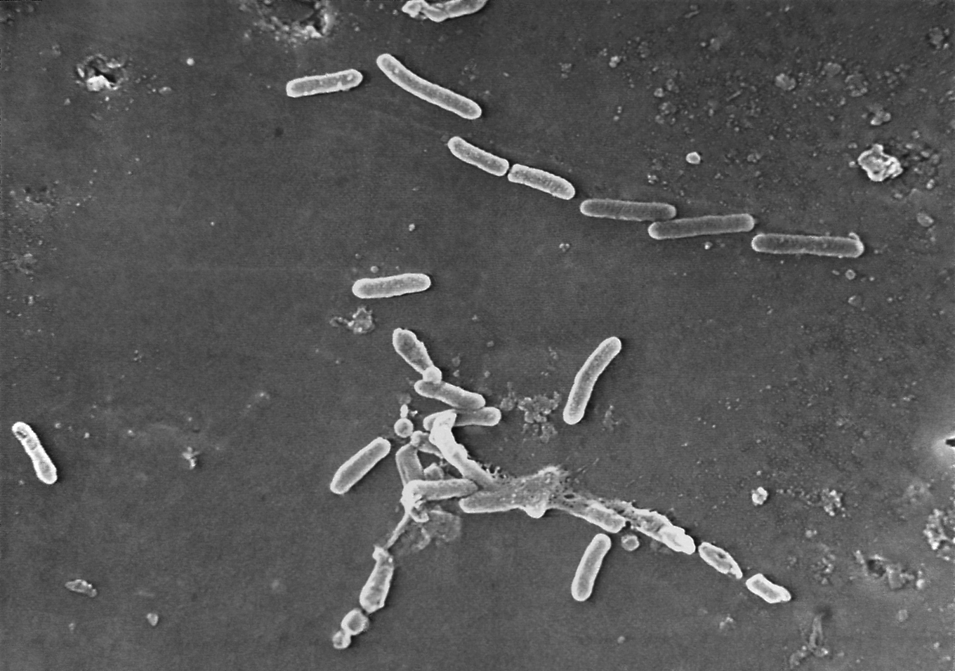 Antalet antibiotikaresistenta bakterieinfektioner ökar, varnar WHO. Arkivbild. Foto: Janice Haney Carr/CDC via AP/TT
