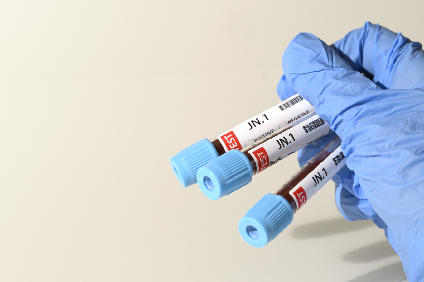 Transportstyrelsen föreslår att slopa peth-tester. Arkivbild. Foto: Mikael Fritzon/TT