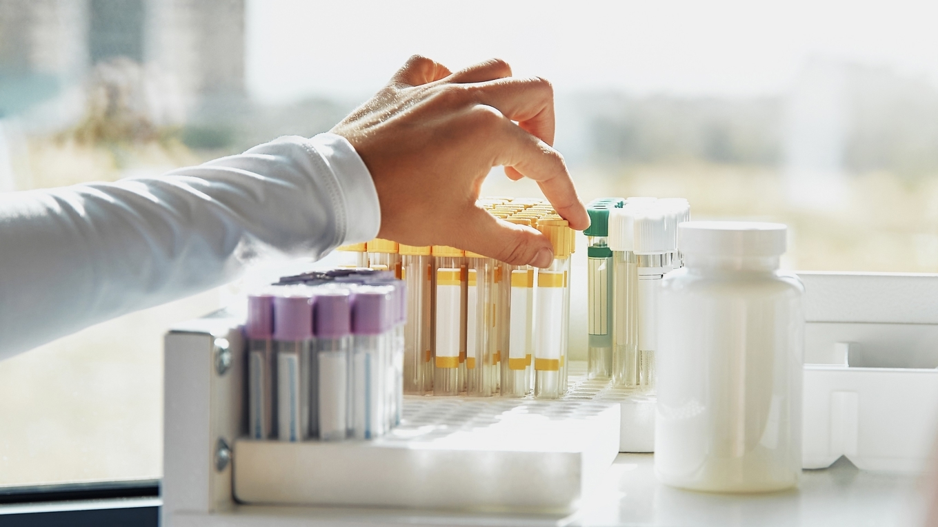 Inom funktionsmedicin tar man många prover och analyserar hundratals biomarkörer för att kunna behandla orsak i stället för symtom. Foto: Shutterstock