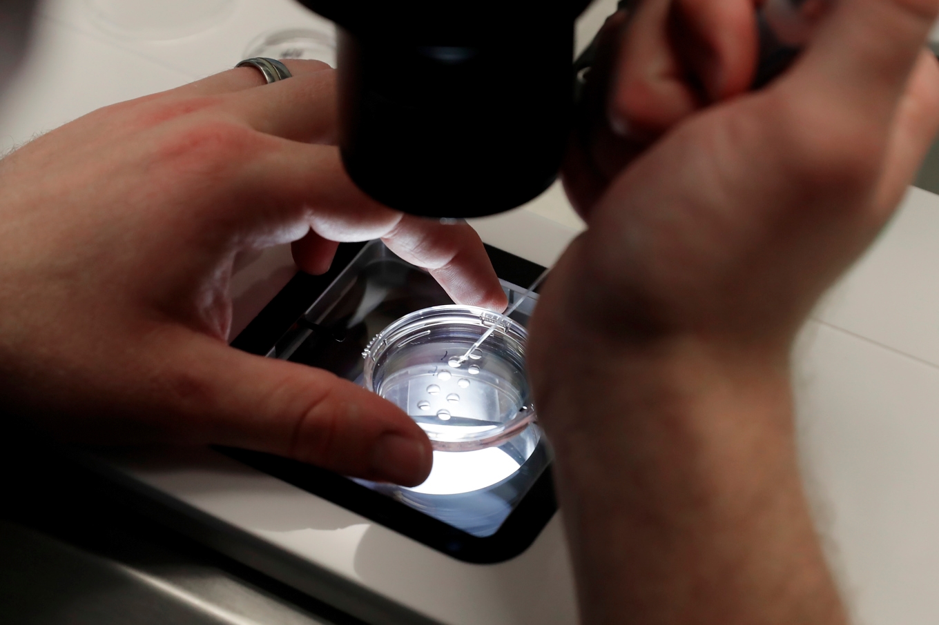Vid ivf sker befruktning av ägget på labb och embryot förs sedan in i kvinnans kropp. Arkivbild Foto: Michael Wyke/AP/TT