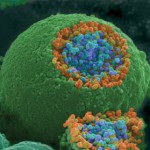 Nervändar. (Foto: Tina Carvalho/National Institutes of Health)