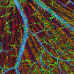 Näthinna. (Foto: National Center for Microscopy and Imaging Research)