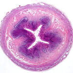 Blindtarm. Tvärsnitt av en människas blindtarm sett genom ett ljusmikroskop med liten förstoring. (Shutterstock)