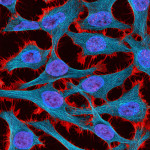 Cancer. (Foto: Tom Deernick via National Institutes of Health)