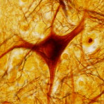 Ryggmärg. (Foto: Shutterstock)