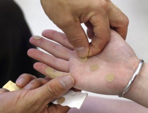 Koreansk handakupunktur är en unik akupunkturbehandling som inte använder nålar. (Foto: Tim Boyle/Getty Image)