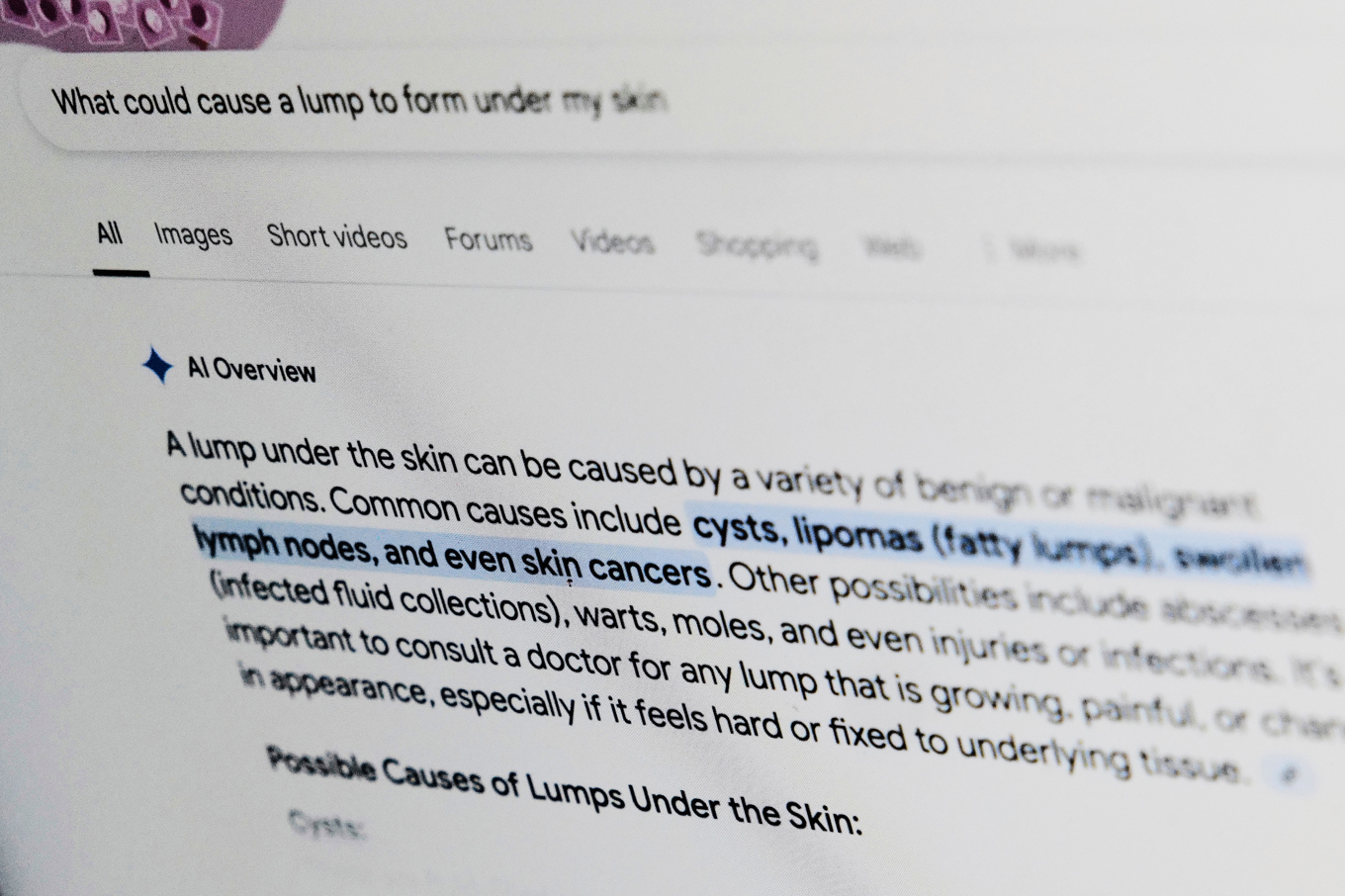 En AI-genererad Googleträff. Arkivbild. Foto: Patrick Sison/AP/TT